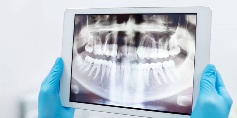 خدمات دندانپزشکی با تخفیف ویژه