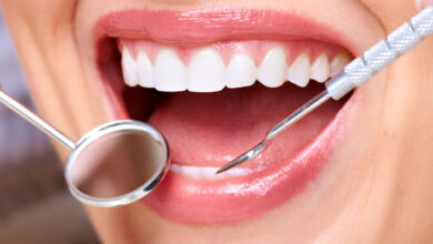 خدمات دندانپزشکی باشگاه رانندگان اسنپ